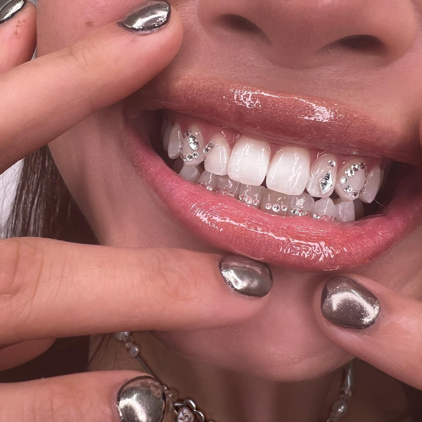 Grillz o joyas dentales, la nueva tendencia que triunfa entre las celebridades